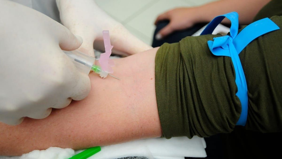 Veja que exame de sangue detecta câncer de pâncreas inicial antes dos sintomas aparecerem