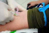 Veja que exame de sangue detecta câncer de pâncreas inicial antes dos sintomas aparecerem