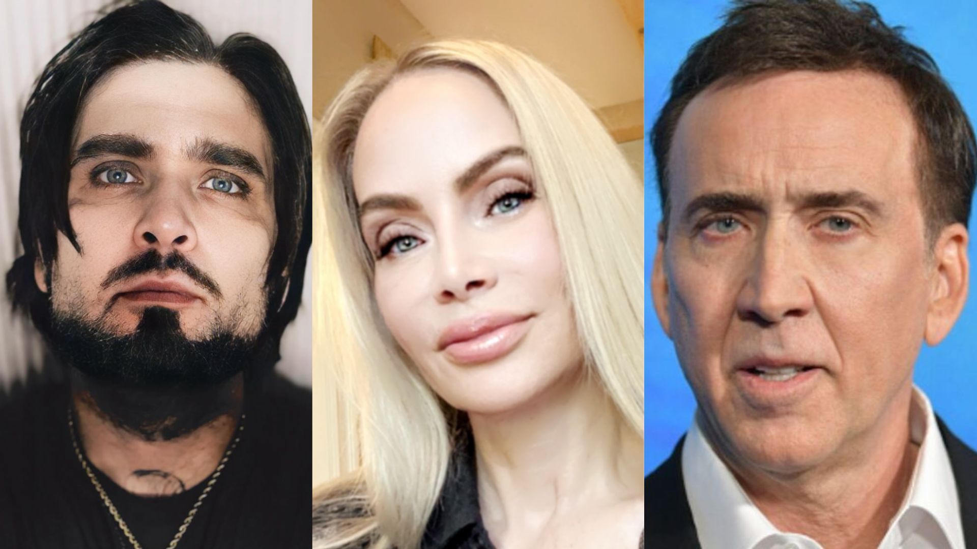 Ex de Nicolas Cage mostra ferimentos após agressões de filho com o ator