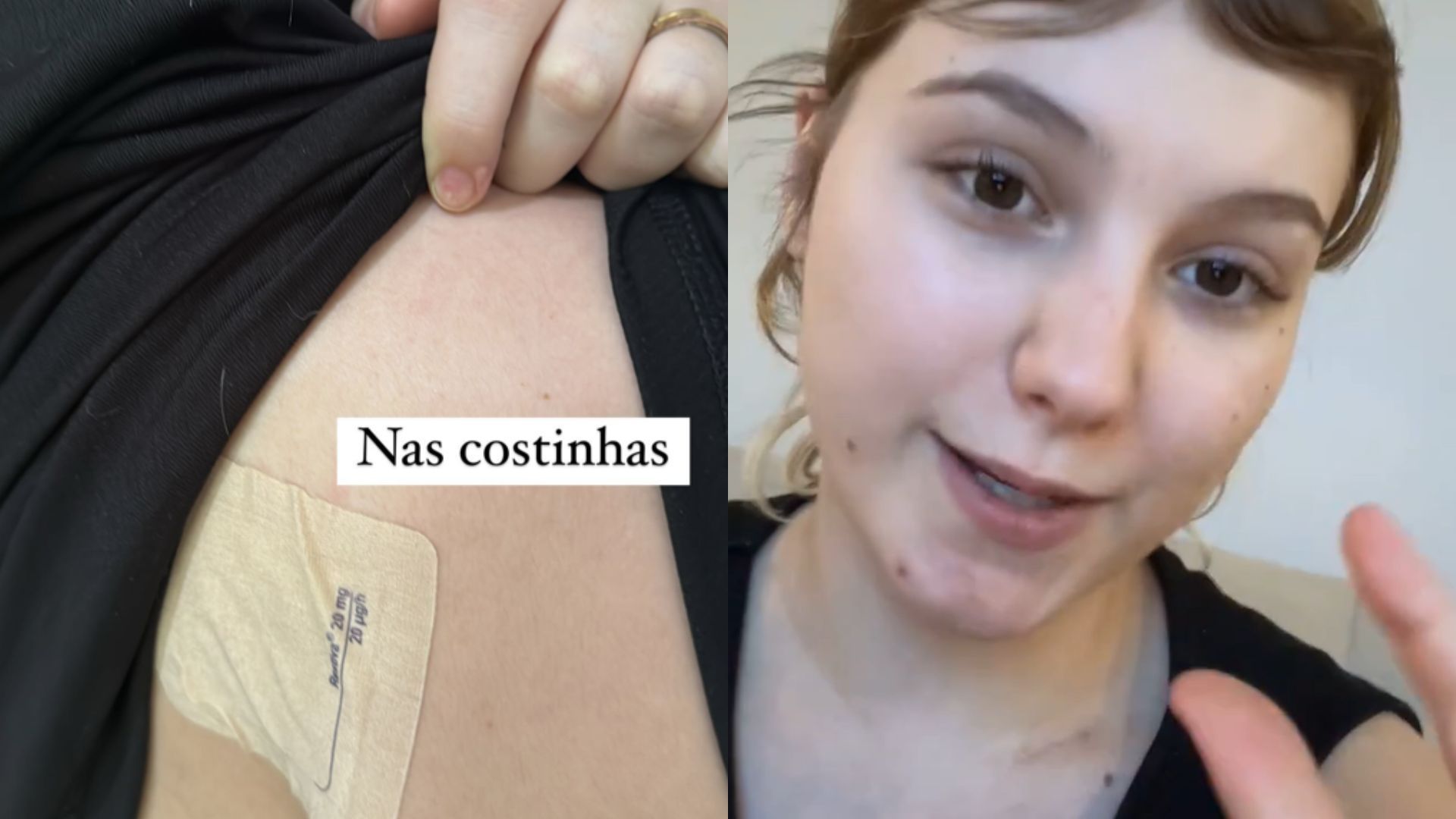 Com câncer terminal, Isabel Veloso compartilha problemas com alergias no braço e pernas