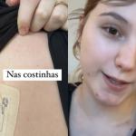Com câncer terminal, Isabel Veloso compartilha problemas com alergias no braço e pernas
