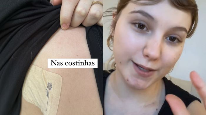 Isabel Veloso compartilha detalhes de alergias com seguidores