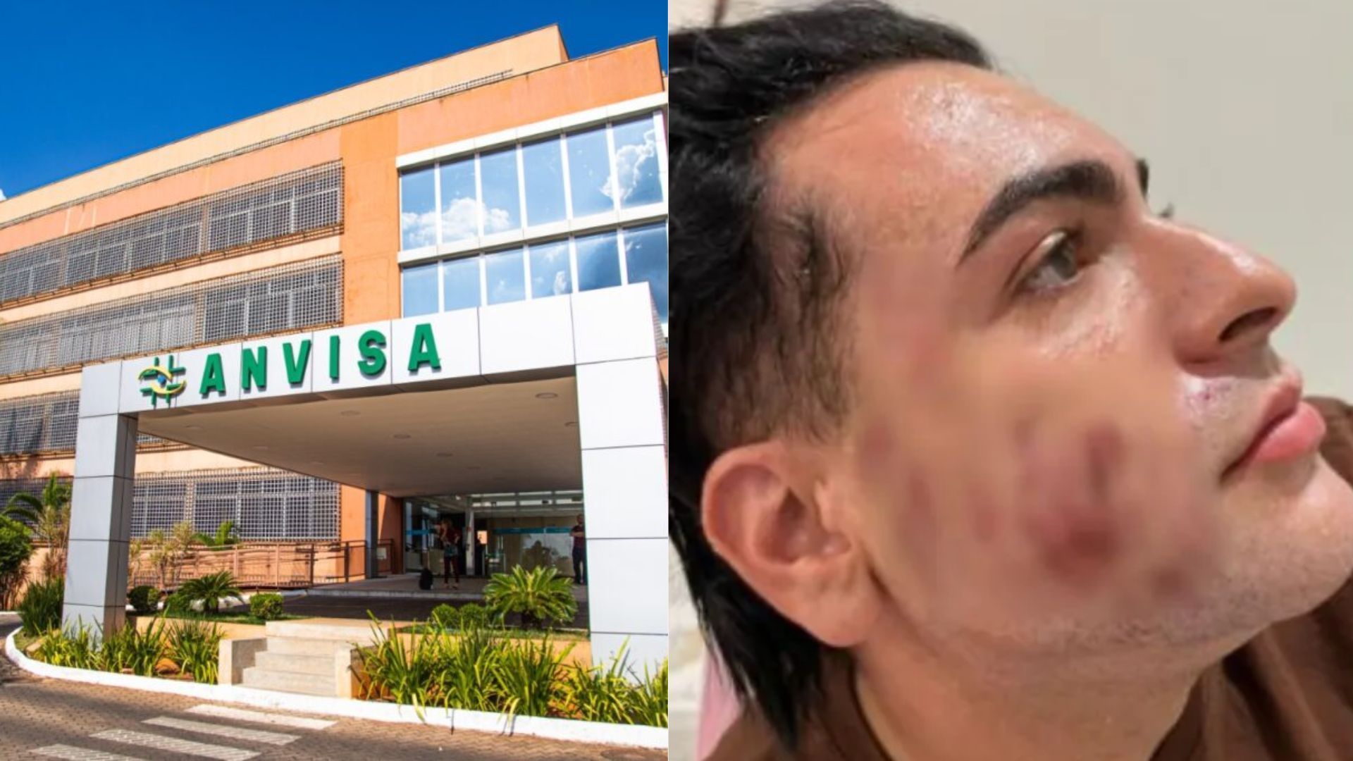 Após morte de empresário, Anvisa proíbe venda e uso de produtos à base de fenol