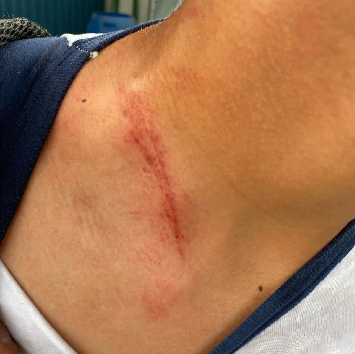 Professor é denunciado por agredir aluno especial de 13 anos em escola de MG