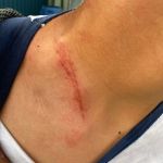 Professor é denunciado por agredir aluno especial de 13 anos em escola de MG