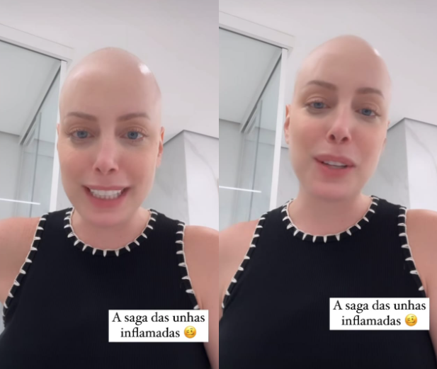 Com câncer, Fabiana Justus conta sobre tratamento de inflamação nos pés: 'Dói muito'