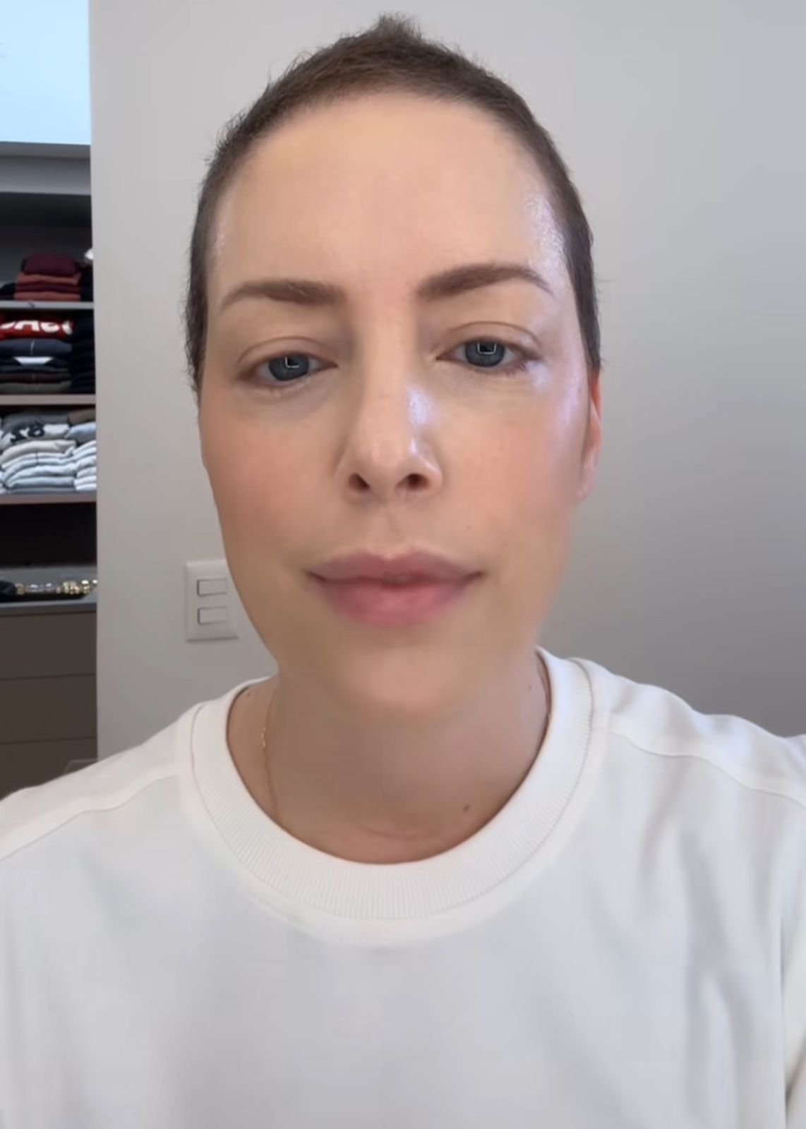 Após transplante de medula, Fabiana Justus passará por novo procedimento; entenda