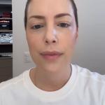 Após transplante de medula, Fabiana Justus passará por novo procedimento; entenda