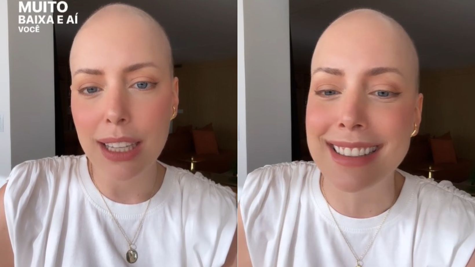 Após câncer, Fabiana Justus conta novidade sobre pós-transplante: 'sem palavras'