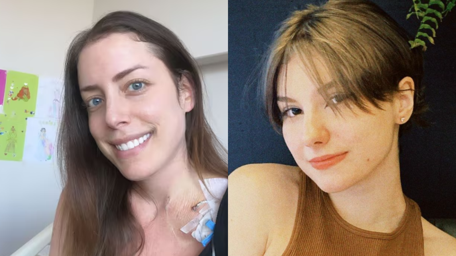 Fabiana Justus passou por transplante de medula alogênico e Isabel Veloso por autólogo; saiba diferença