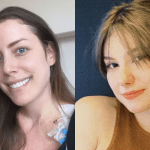 Fabiana Justus passou por transplante de medula alogênico e Isabel Veloso por autólogo; saiba diferença