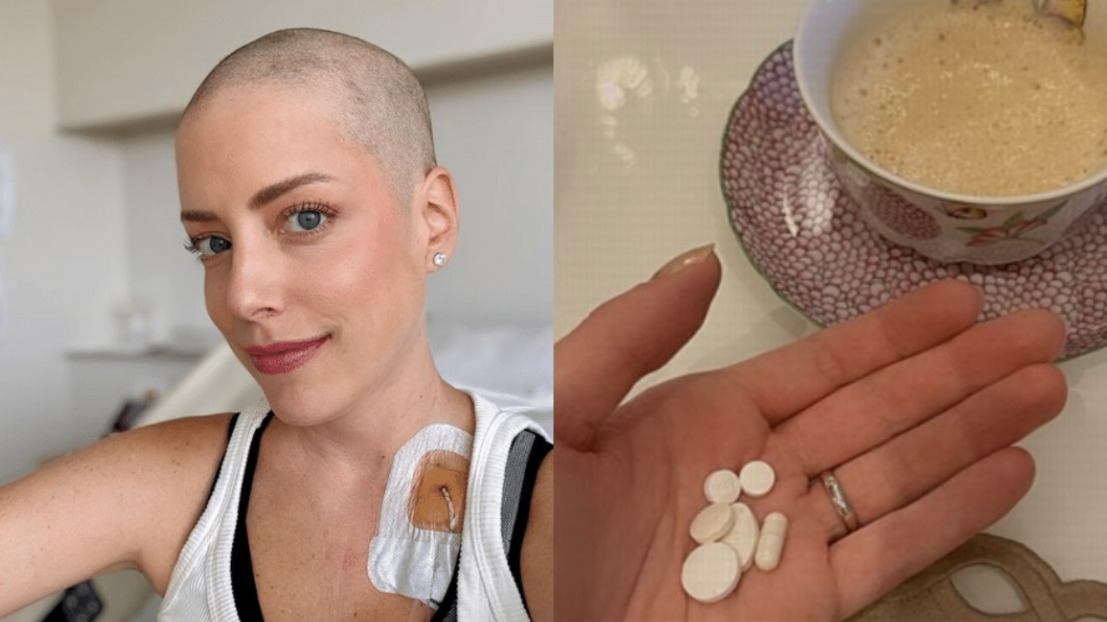 Fabiana Justus revela que está tomando mais de 40 remédios por dia após transplante de medula