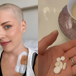 Fabiana Justus revela que está tomando mais de 40 remédios por dia após transplante de medula