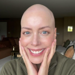 Fabiana Justus revela ter perdido impressões digitais ao tratar câncer