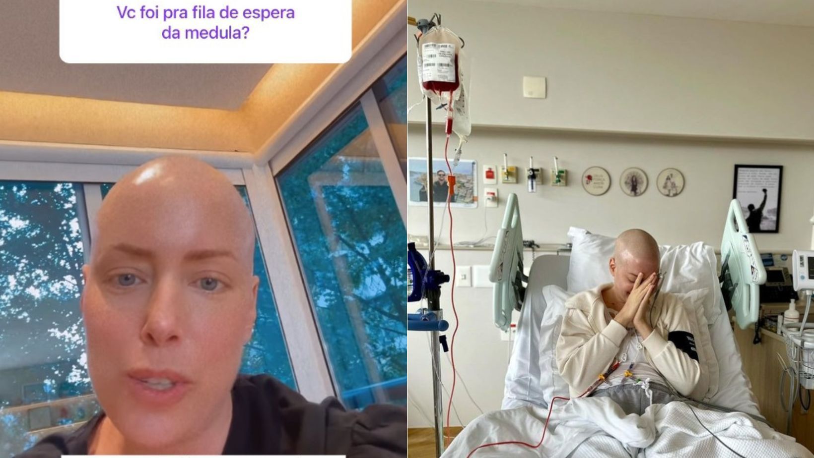 Fabiana Justus explica por que não ficou na fila para o transplante de medula; entenda