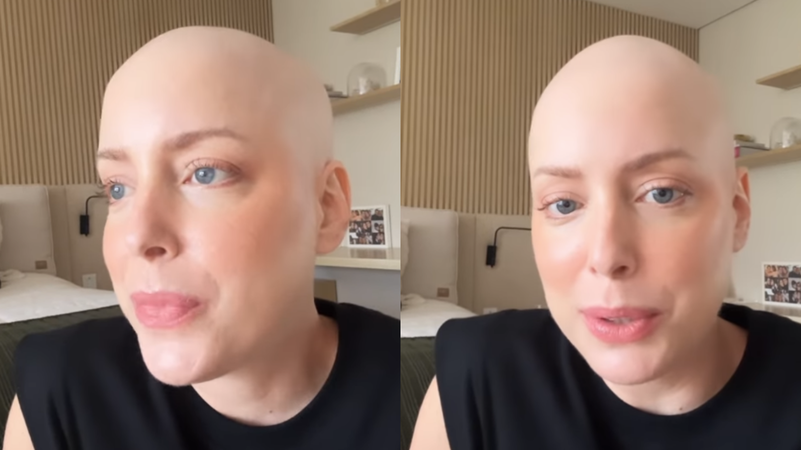 Fabiana Justus relata consequência do tratamento de câncer: 'Queria mostrar'