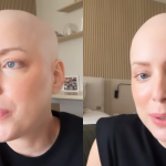 Fabiana Justus relata consequência do tratamento de câncer: 'Queria mostrar'