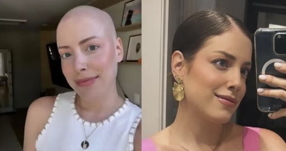 Em tratamento de câncer, Fabiana Justus reflete sobre queda de cabelo: 'sensação que estou de cabelo preso'