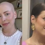 Após tratamento de câncer, Fabiana Justus explica por que cabelo não cresceu