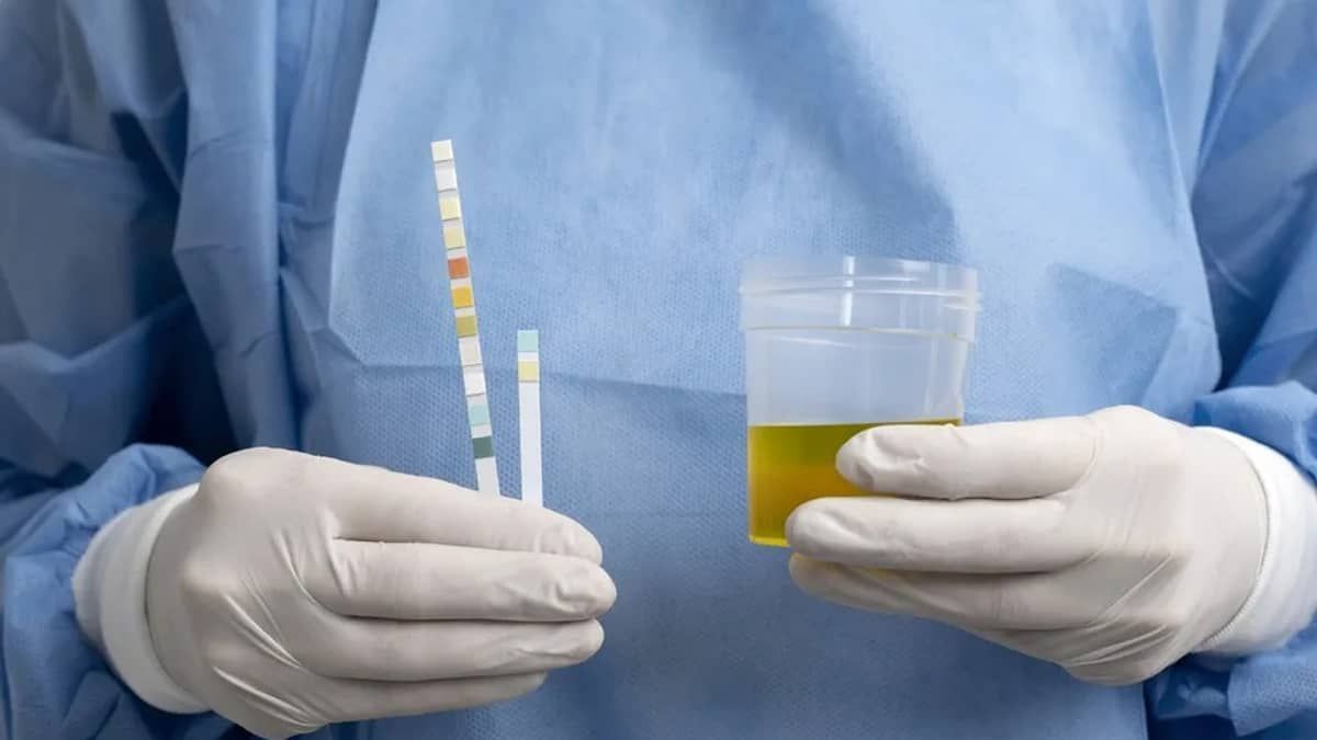Farmácias são autorizadas a realizarem exames de análises clínicas; saiba quais