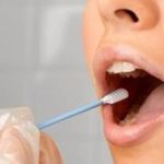 São João del Rei oferece testes rápidos para a detecção da bactéria Streptococcus