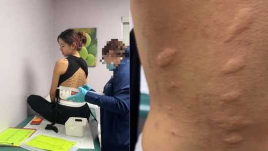 Em uma publicação no TikTok, ela mostrou como foi o exame que descobriu a condição