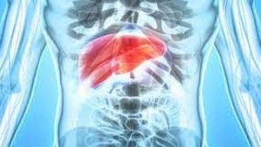 A esteatose hepática, também conhecida como gordura no fígado, atinge um terço da população do mundo, segundo o cirurgião geral Leonardo Emilio