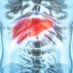 Gordura no fígado pode ser evitada com hábitos saudáveis, diz especialista