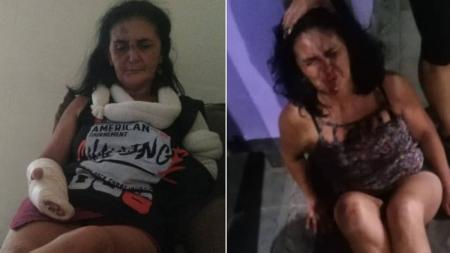 Filho mostra fotos da mãe ferida