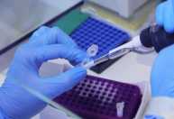 Fiocruz revela resultado de exames após suspeita de Ebola em paciente do Rio vindo de Uganda