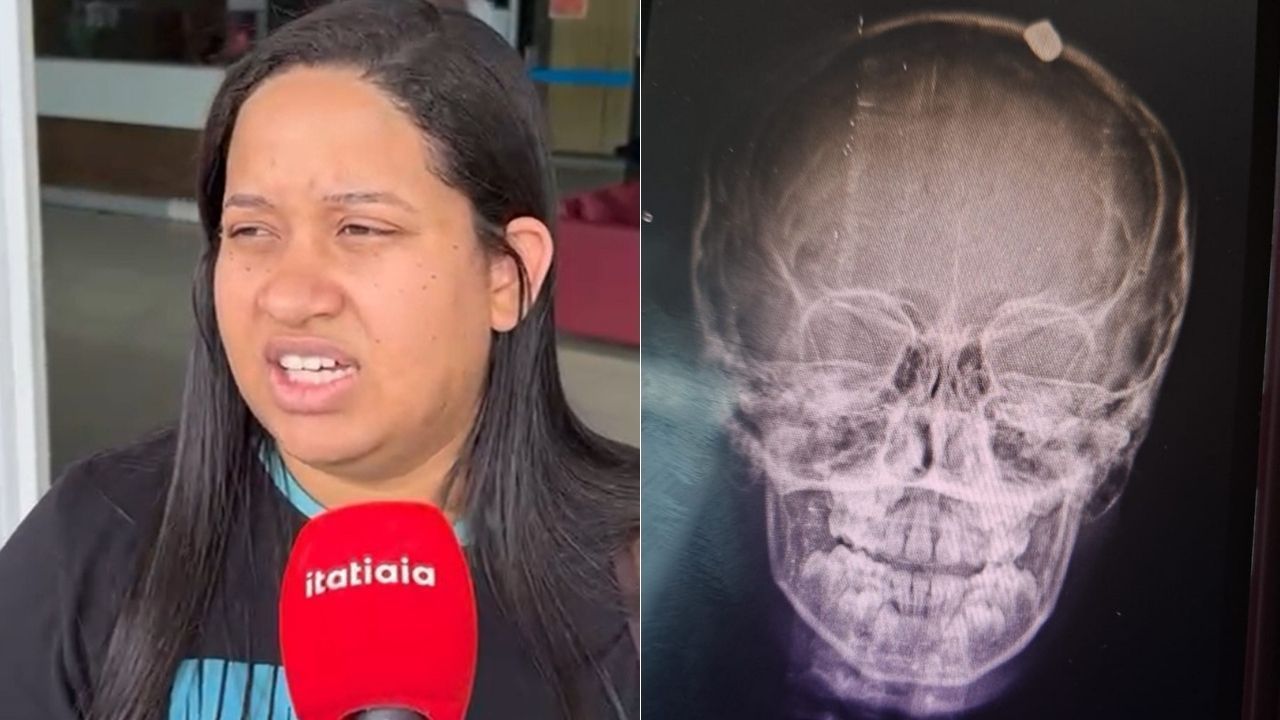 ‘Um milagre’, diz irmã de menino que sobreviveu após bala perdida no Ano-Novo na Grande BH