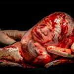 Bebê empelicado: fotógrafa mineira recebe maior média em concurso de fotografia sobre parto