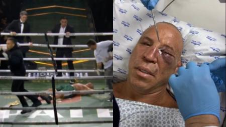 Wanderlei Silva foi nocauteado após a luta