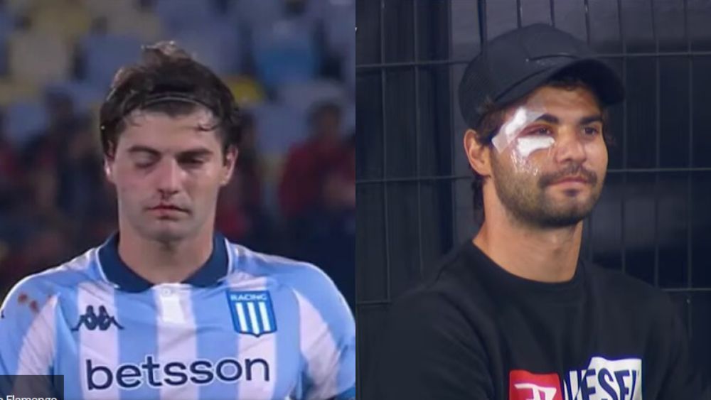 Racing x Flamengo: argentino vai ao jogo e chama atenção por 'rosto desfigurado'
