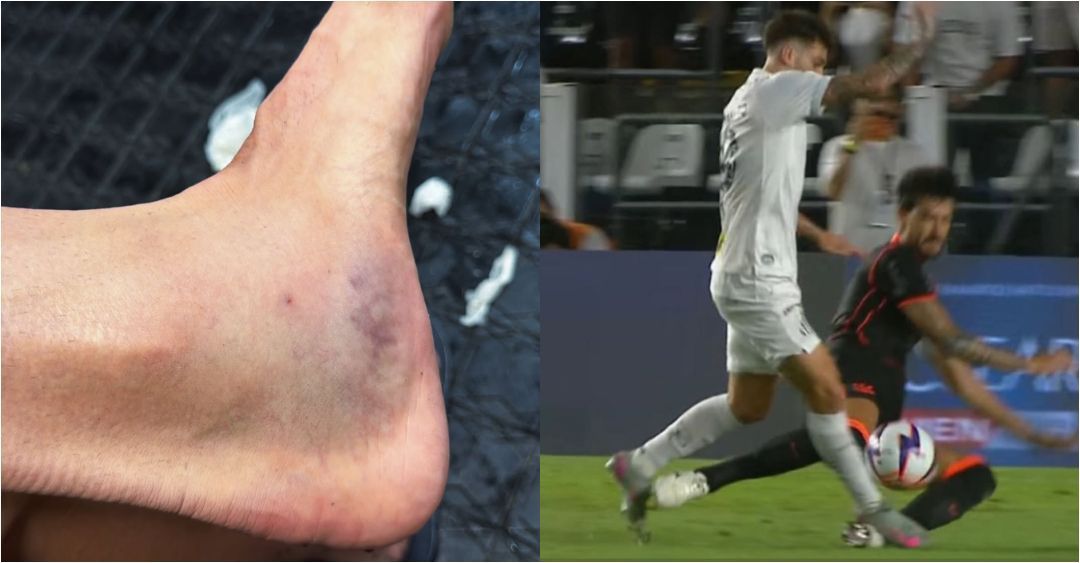Zagueiro do Corinthians vai às redes e ironiza falta que originou gol de Gabigol