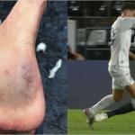 Zagueiro do Corinthians vai às redes e ironiza falta que originou gol de Gabigol