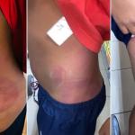 Mãe denuncia pai que teria agredido filho de 9 anos por pular no sofá: 'choro desesperadamente’