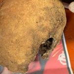 Polícia encontra fragmento de possível crânio humano, em Aimorés