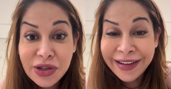 Maíra Cardi mostrou que rosto ficou deformado após procedimento