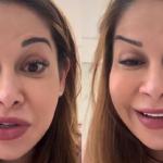 Maíra Cardi reclama de procedimento estético e divide opiniões: 'Ridícula'