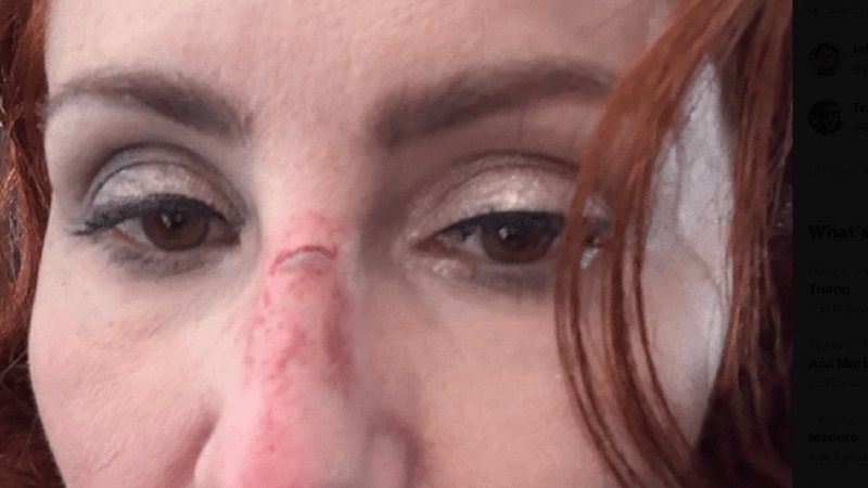 Carla Zambelli sofre acidente em avião a caminho dos EUA