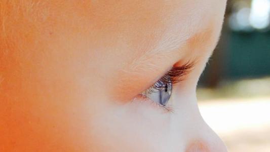 Glaucoma não tenha cura, tem tratamento
