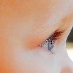 Cartilha alerta sobre glaucoma infantil, doença responsável por 5% dos casos de cegueira em crianças