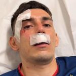 Fortaleza detalha lesões dos jogadores após ônibus ser atacado por torcida do Sport