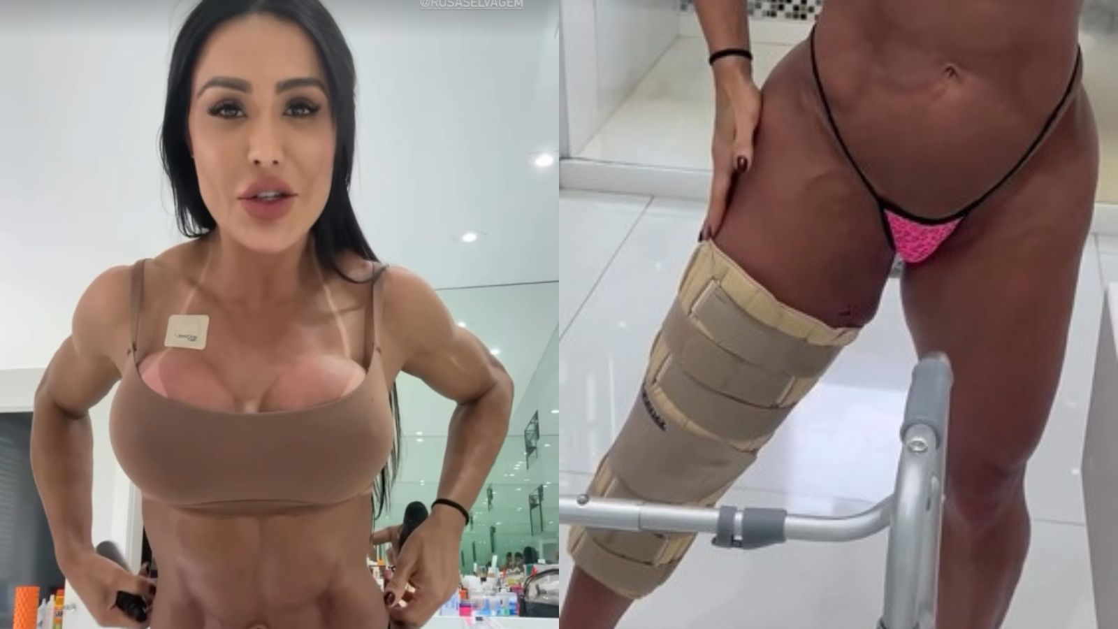 Gracyanne Barbosa exibe corpo após lesão na Dança dos Famosos: 'Quero me recuperar'