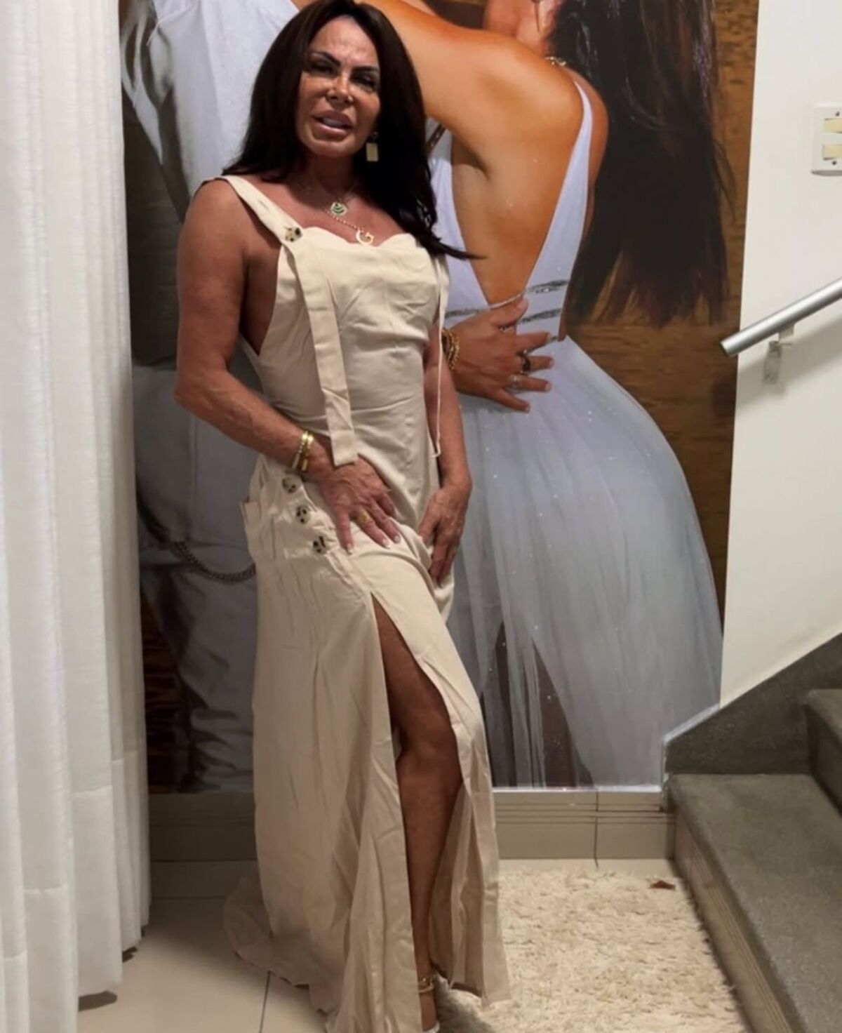 Diagnosticada com doença autoimune, Gretchen compartilha evolução do tratamento: 'Não me importo'