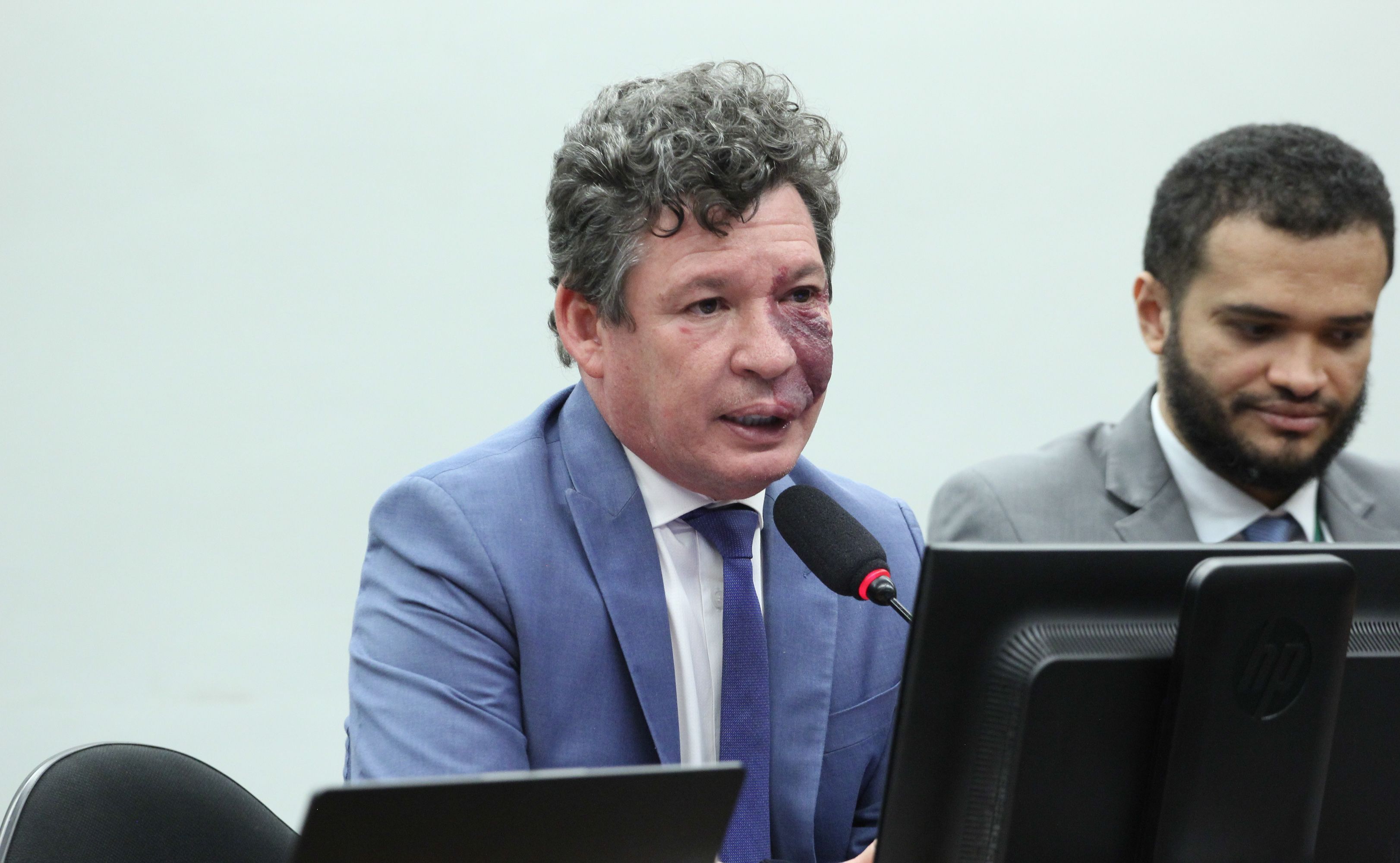 Deputado quer análise do STF sobre constitucionalidade da reforma tributária para evitar judicializações