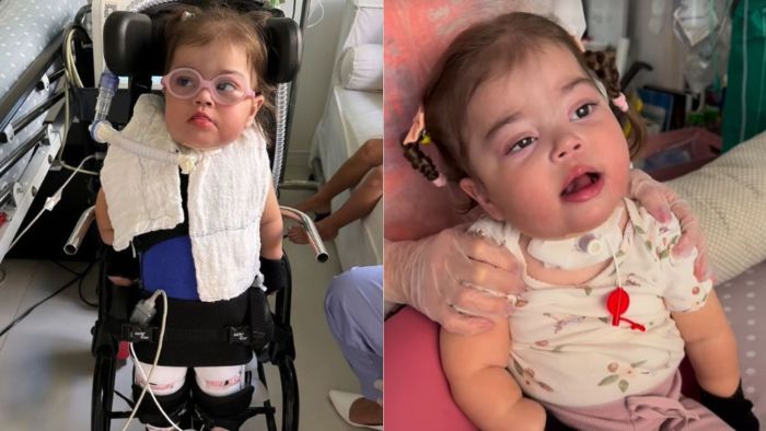 Maria Guilhermina, de 2 anos, filha de Juliano Cazarré, não precisa mais de aparelho de respiração durante à noite. Maria Guilhermina, de 2 anos, filha de Juliano Cazarré, não precisa mais de aparelho de respiração durante à noite.