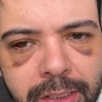 Humorista Gustavo Mendes diz ter se equivocado ao dizer que foi vítima de assalto