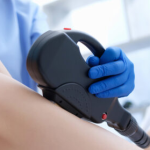 SAÚDE: Entenda como o laser pode auxiliar no pós-parto e na menopausa